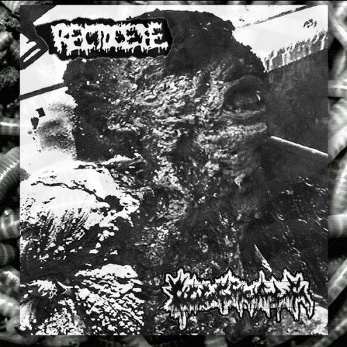 Rectocele : Rectocele - Cx9